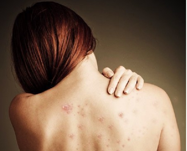 Có nên dùng sữa tắm hàng ngày không