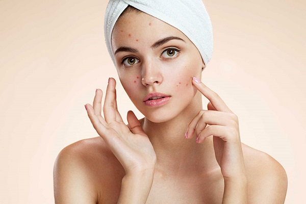 Cách làm sữa rửa mặt tại nhà dành cho da mụn