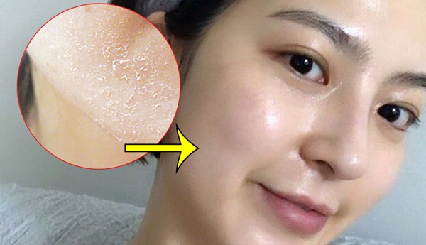Lưu ý sử dụng sữa rửa mặt dành cho da khô